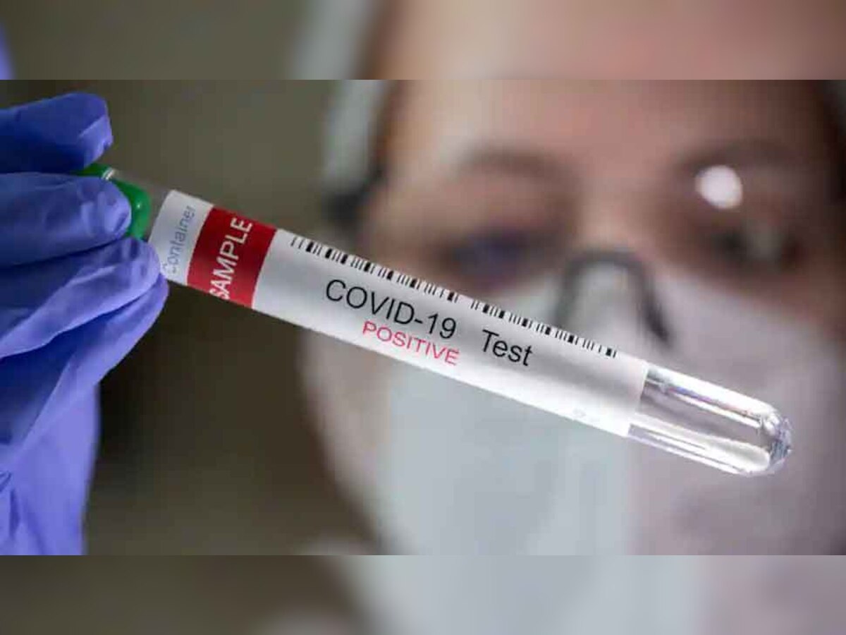 Coronavirus : बापरे...अमेरिकेत एका आठवड्यात सुमारे 48,000 मुलांना कोरोनाची लागण  title=