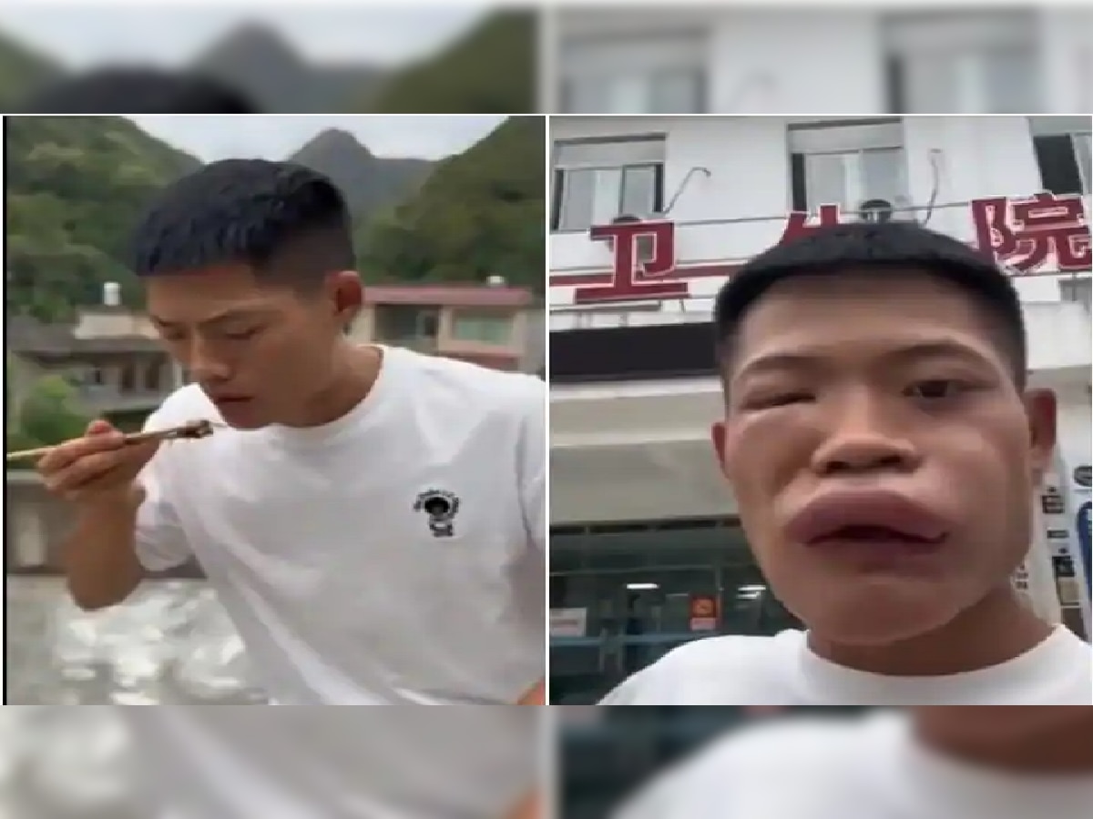 Shocking Video : जिवंत कीडा खाणं तरुणाला पडलं महाग, बघा चेहऱ्याची काय अवस्था झाली title=
