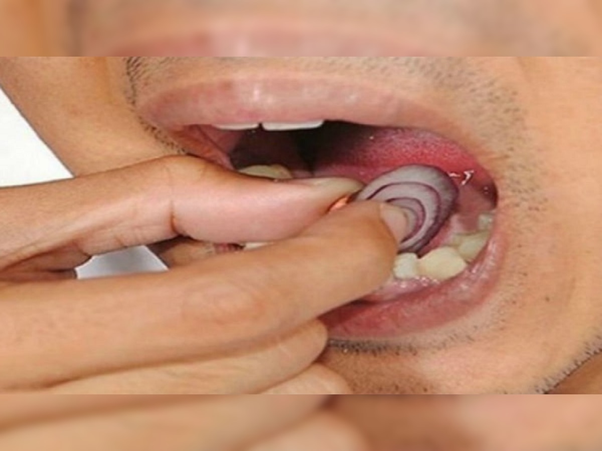 Tooth Ache remedies: दातदुखी की डोकेदुखी...असह्य वेदना कमी करणं आता शक्य...तेही घरगुती उपायांनी  title=