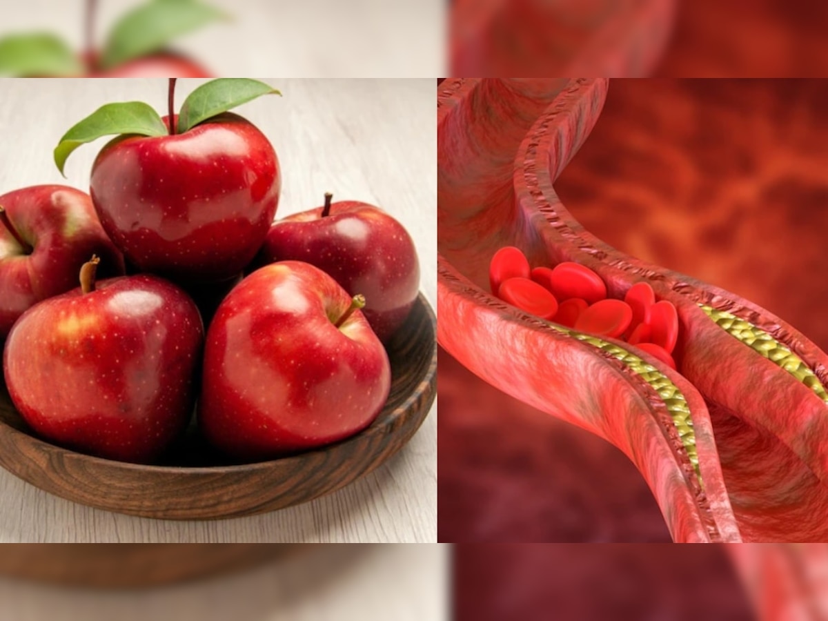 High Cholesterol: थंडीच्या दिवसात आहारात या फळांचा समावेश करा, वितळून जाईल नसांत जमा झालेले कोलेस्ट्रॉल  title=
