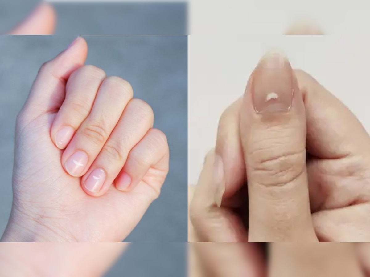 White Spot on Nails: लकी ठरते नखावरील ही छोटी निशाणी, जीवनात धनसंपत्तीसह मिळते ऐश्वर्य title=