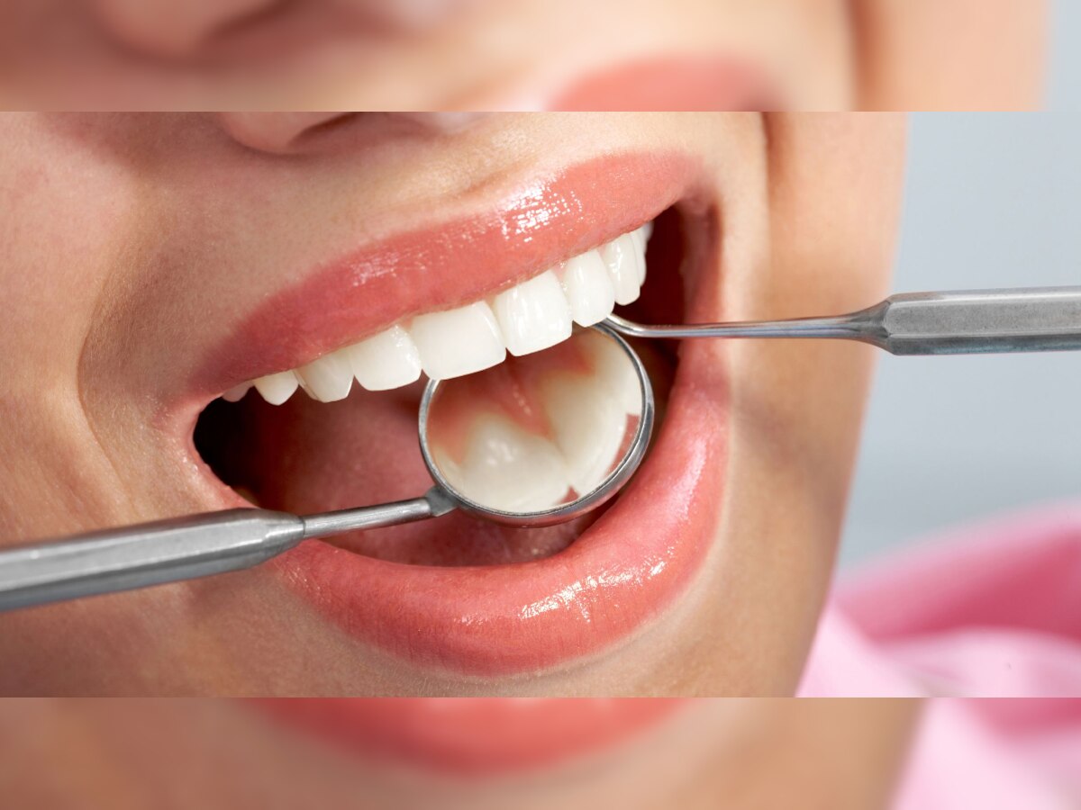 Teeth Cleaning: मोत्यासारखे पांढरे शुभ्र हवेत? 'हे' घरगुती उपाय करून पाहा title=