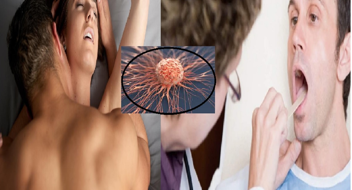 Mouth Cancer : धक्कादायक! Oral Sex मुळे तोंडाच्या कॅन्सरच्या प्रमाणात वाढ ? पाहा काय म्हणाले एक्सपर्ट्स....