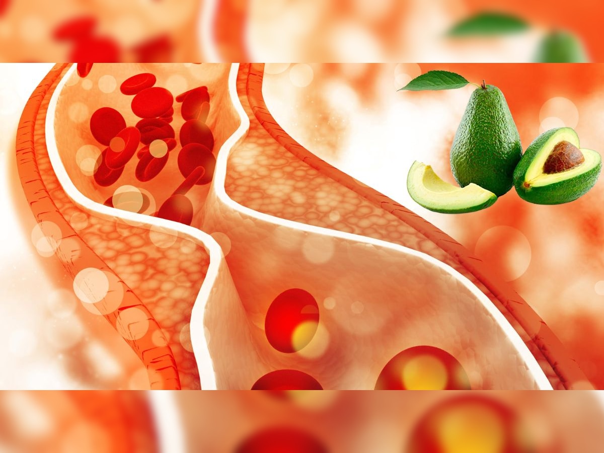 High Cholesterol : वाढलेलं कोलेस्ट्रॉल कमी करायचंय? मग आहारात 'या' फळाचा करा समावेश  title=