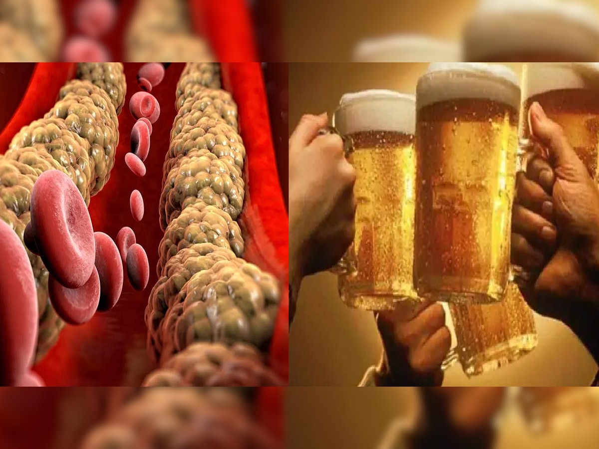 Cholesterol :  Beer प्यायलामुळे खरंच कोलेस्ट्रॉल कमी होतं? जाणून घ्या काय सांगतात तज्ज्ञ title=