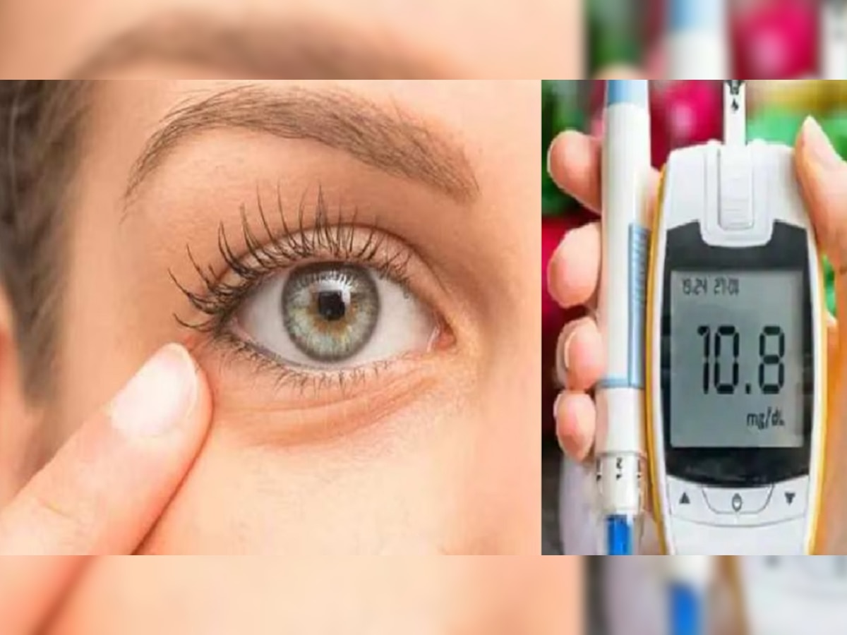 Diabetes Symptoms from Eye: तुमच्या डोळ्यात दिसतात डायबिटिजचे संकेत? 'या' लक्षणांकडे दुर्लक्ष करू नका... title=