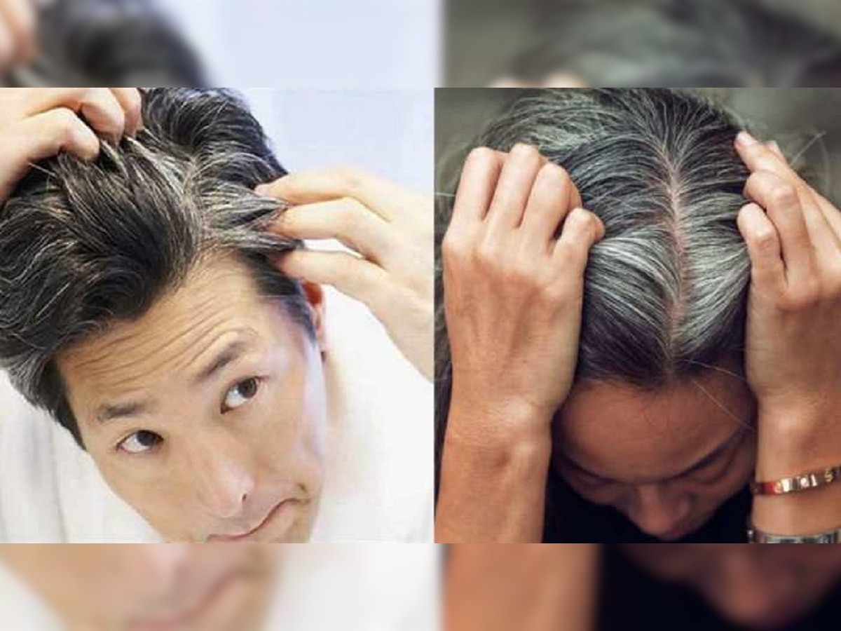 White Hair Problem: तरुणपणातच केस पांढरे होतायत का? जाणून घ्या कारणं आणि त्यावरील उपाय title=