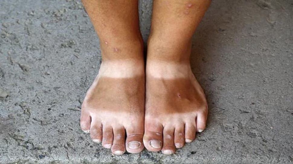 Skin Tanning skin-tanning