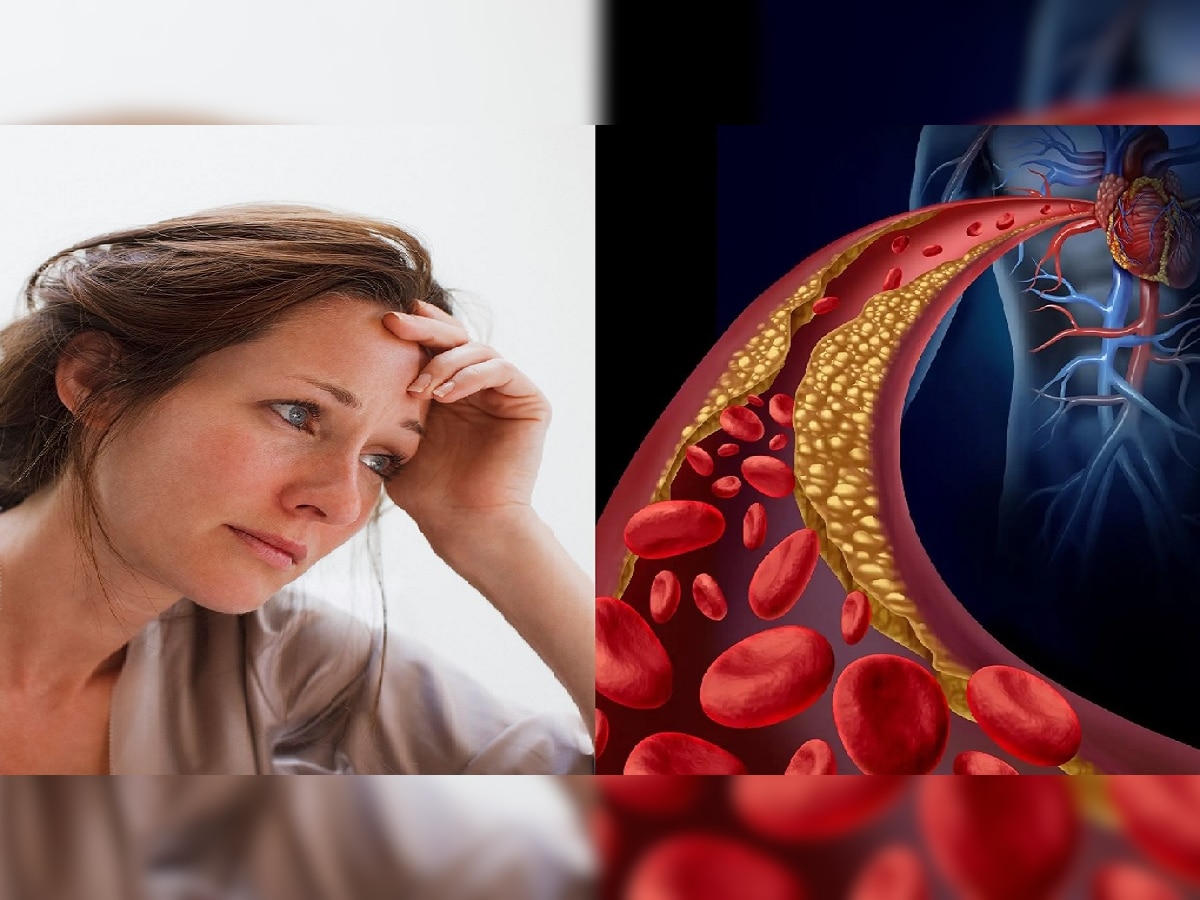 Cholesterol Level in Women : महिलांमध्ये उच्च कोलेस्टेरॉलची लेव्हल कशी ओळखाल? title=