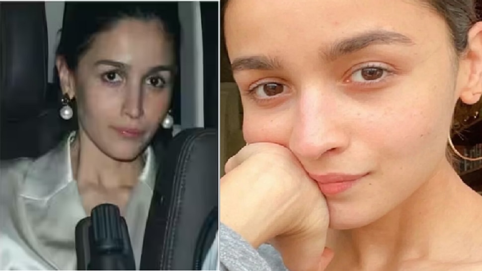 Alia Bhatt Got Botox Surgery Done After Becoming A Mother Instead Of The Actress The Look Opened 