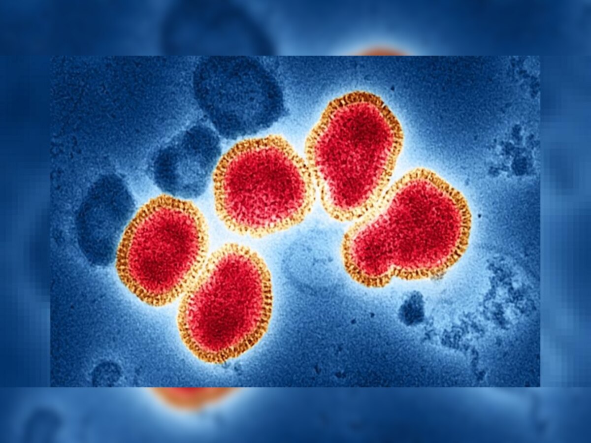 कोरोनाप्रमाणेच घातक ठरतोय नवा H3N2 Virus, अशी घ्या काळजी title=