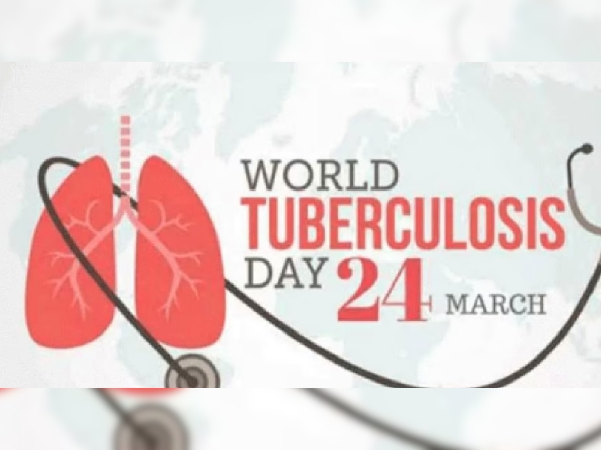 World Tuberculosis Day 2023: जागतिक क्षयरोग दिन 24 मार्चलाच का साजरा केला जातो? यंदाची World TB Day ची थीम काय? title=