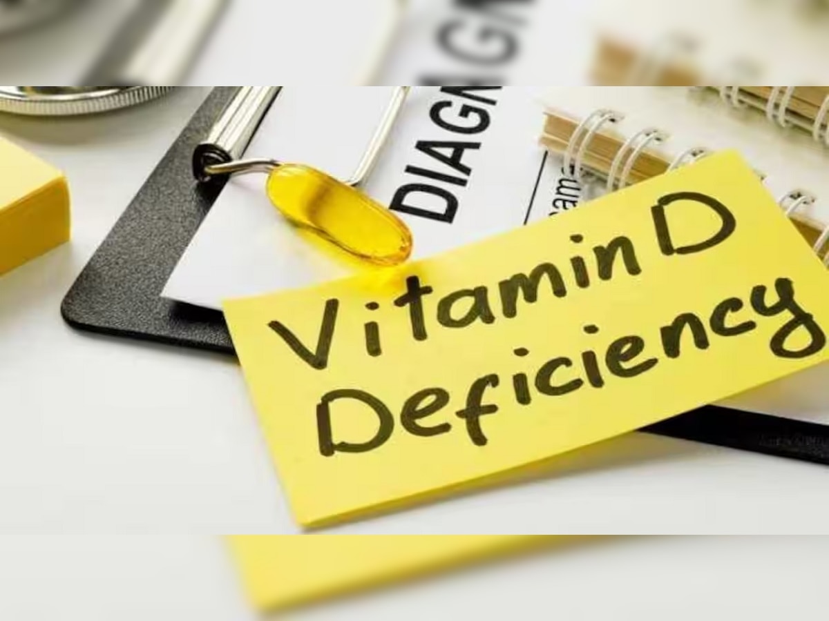 Vitamin Deficiency : व्हिटामीनची कमी झाल्यास होईल शरीरावर वाईट परिणाम, लगेचच बदला तुमचं डायटं title=