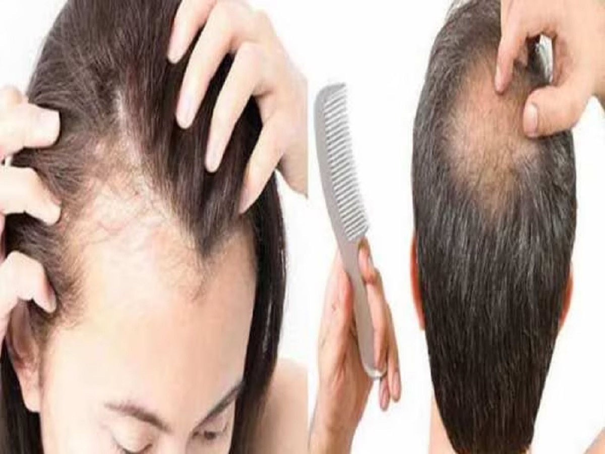 Hairfall Problem: थंड पाण्याने केस धुताय, थांबा! होऊ शकतं नुकसान, कसं ते पाहा title=