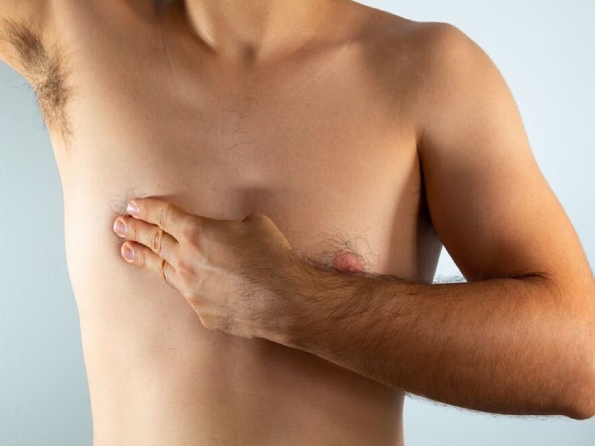 Breast Cancer in Men