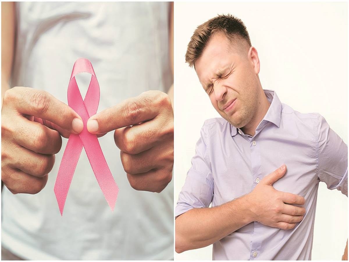 Breast Cancer in Men