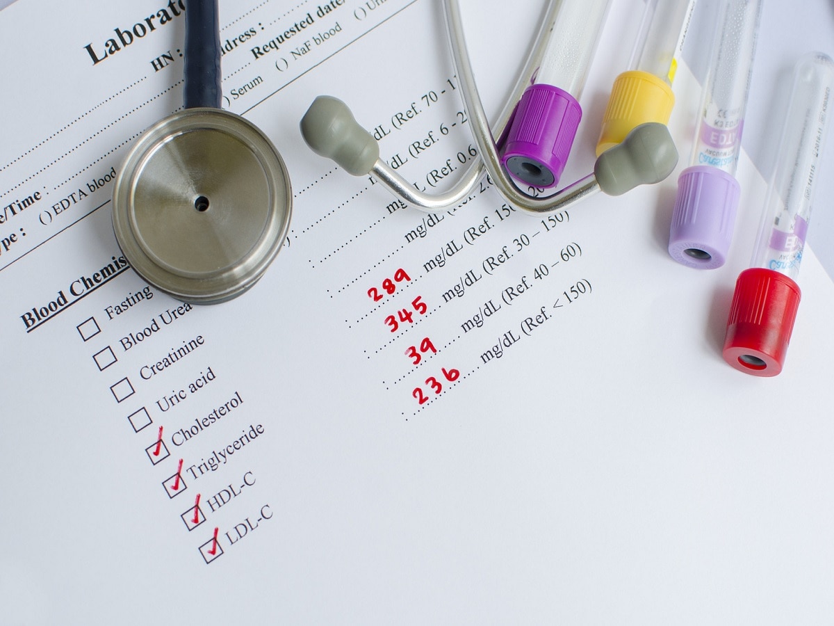 Cholesterol Level : तुमच्या वयानुसार किती असावी कोलेस्ट्रॉलची पातळी? ह्रदयासाठी 'इतकं' प्रमाण धोकादायक title=