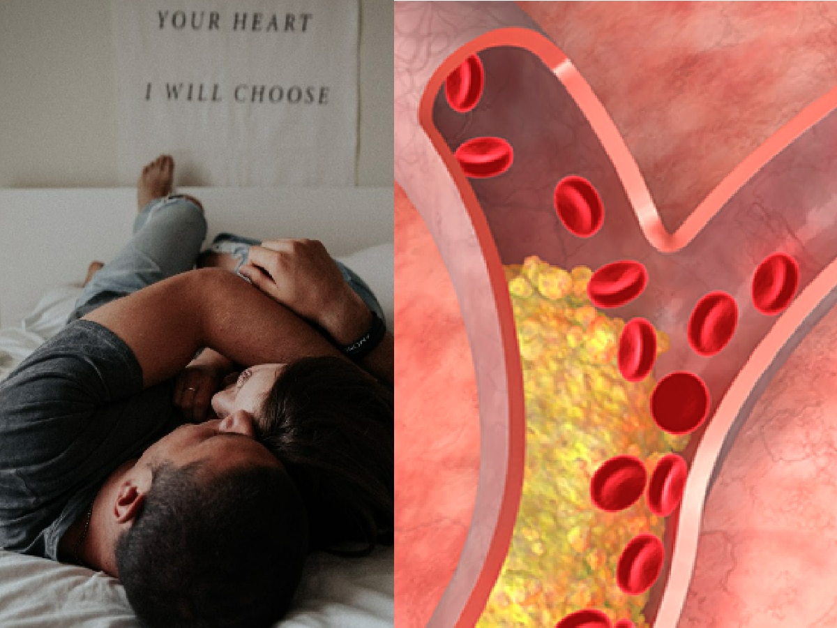 High Cholesterol : सेक्स दरम्यान वेदना होत असतील तर...; हाय कोलेस्ट्रॉलच्या लक्षणांकडे दुर्लक्ष करू नका! title=