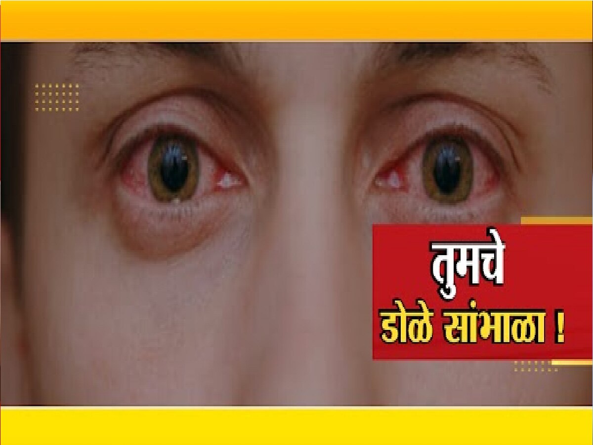 Health News Eye Flu Is Increasing In Mumbai Delhi Know The Symptoms What Is Precaution And Treatment 