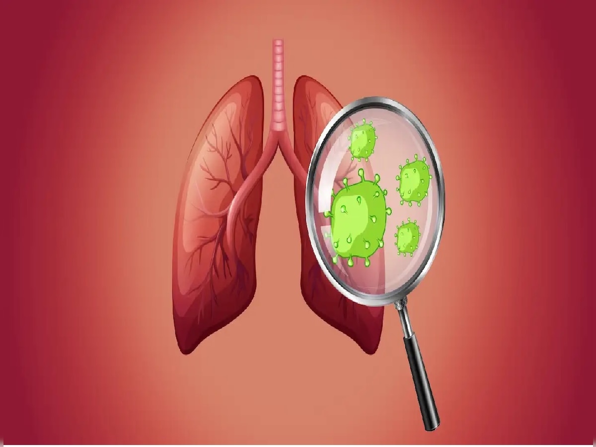 World Lung Cancer Day rise even among non smokers know Reasons symptoms 