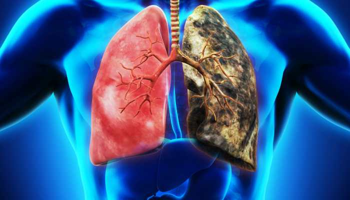 Most Common lung diseases you Must Aware Health Tips in Marathi