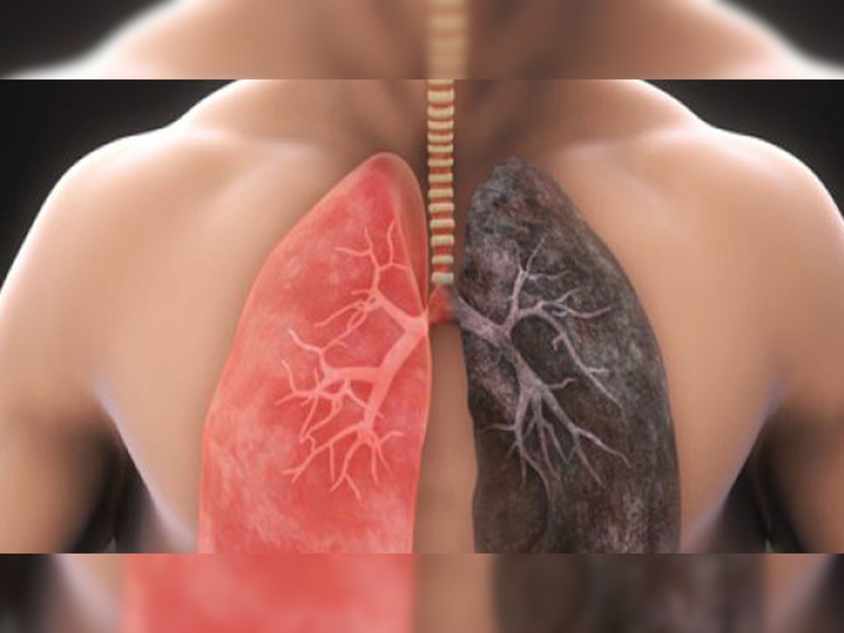 Most Common lung diseases you Must Aware Health Tips in Marathi