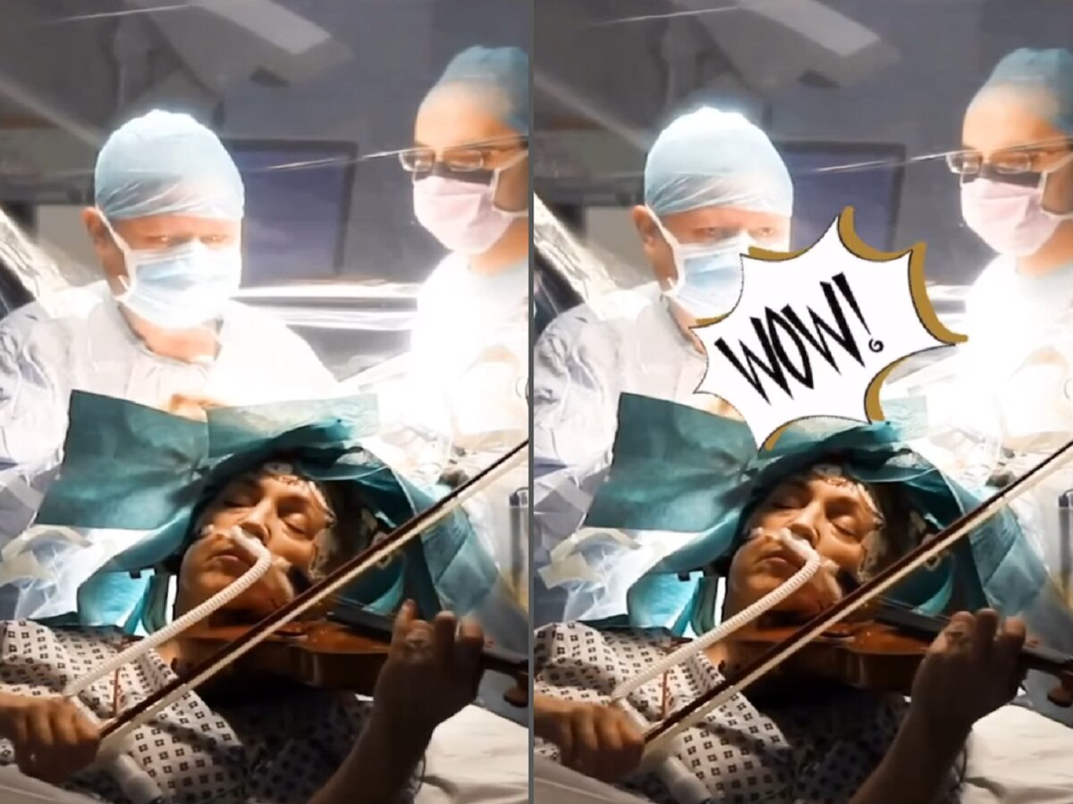 Video : मेंदूच्या शस्त्रक्रियेदरम्यान स्वत:च व्हायोलिन वाजत होती वृद्ध महिला, व्हिडीओ पाहताच डोळ्यात पाणी title=