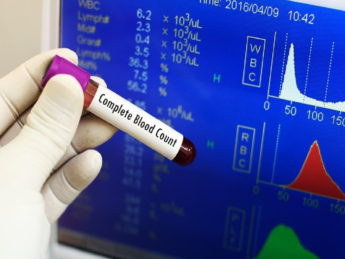 Platelet Count : शरीरात प्लेटलेट्सची संख्या कमी झाल्यानंतर दिसून येतात 'ही' लक्षणं title=