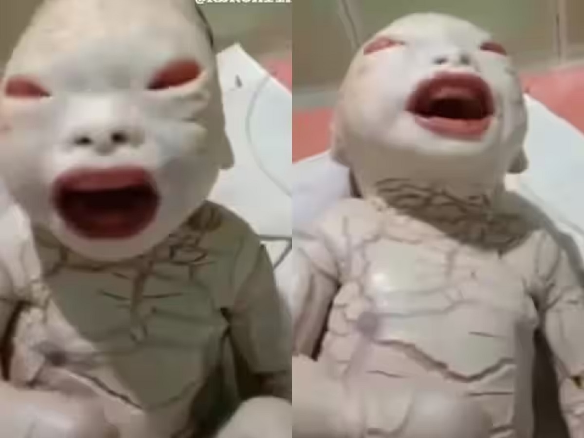 आई गं! महिलेने दिला 'एलियन' सारख्या मुलाला जन्म, डॉक्टरांनाही बसला धक्का! Video Viral  title=