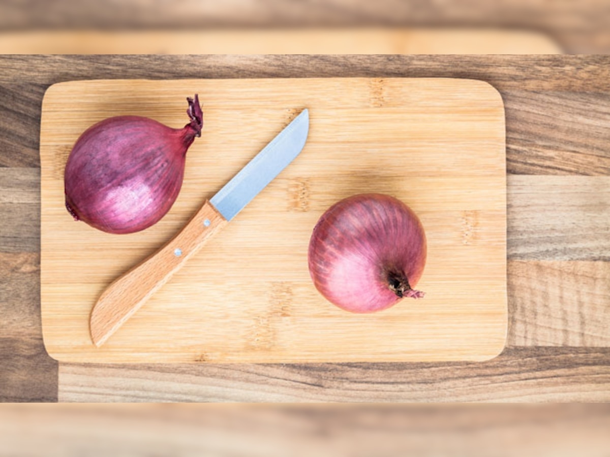 Onion storage Tips at home know before onion prices rise