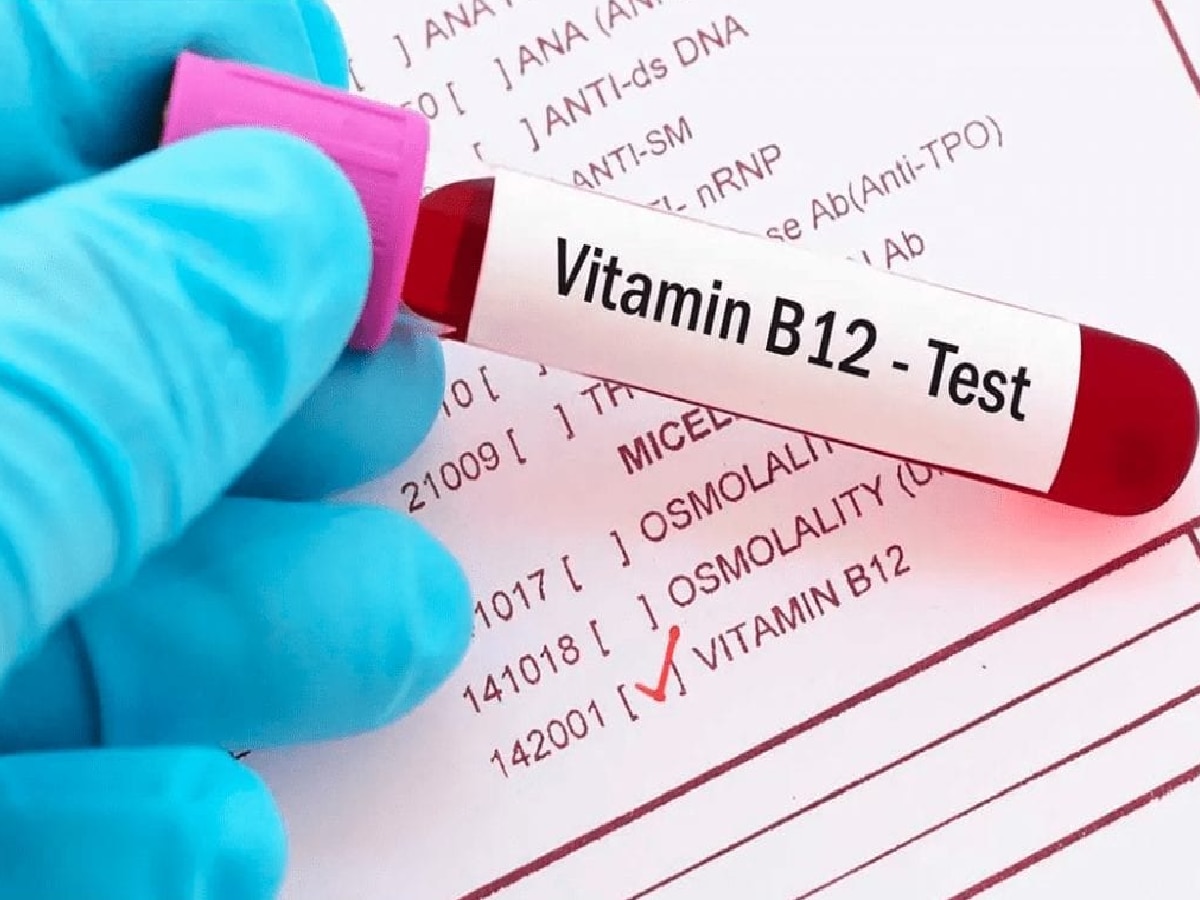 Vitamin B12 How much vitamin B12 should be in your body according to
