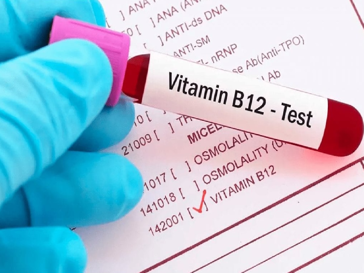 Vitamin B12 : वयोमानानुसार तुमच्या शरीरात व्हिटॅमीन बी 12 चं प्रमाण किती पाहिजे? जाणून घ्या! title=