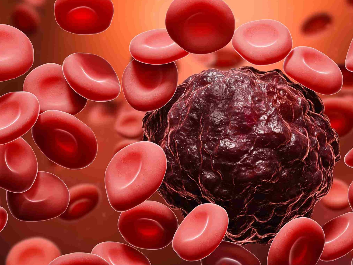 Blood Cancer Cure New CAR T Cell Therapy IIT Bombay Tata Hospital Health Marathi News