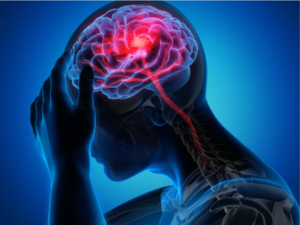 World Stroke Day 2023 : 'या' गोष्टी लक्षपूर्वक केल्यास स्ट्रोकचा धोका होतो कमी title=