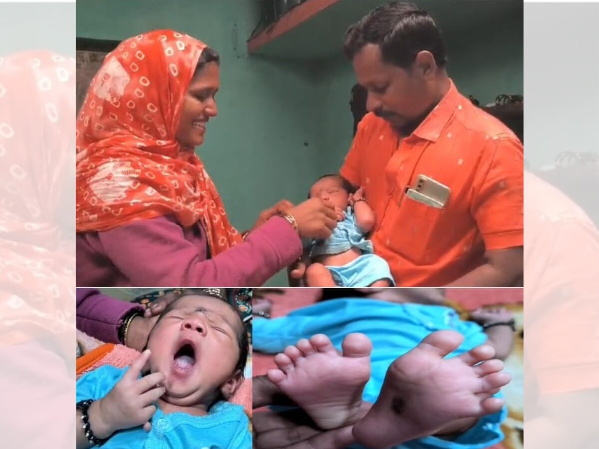 viral news baby with 24 fingers was born in Dharashiv district in Maharashtra; धाराशिव जिल्ह्यात वैद्यकीय क्षेत्रातील दुर्मिळ घटना, 24 बोटांचे बाळ आले जन्माला