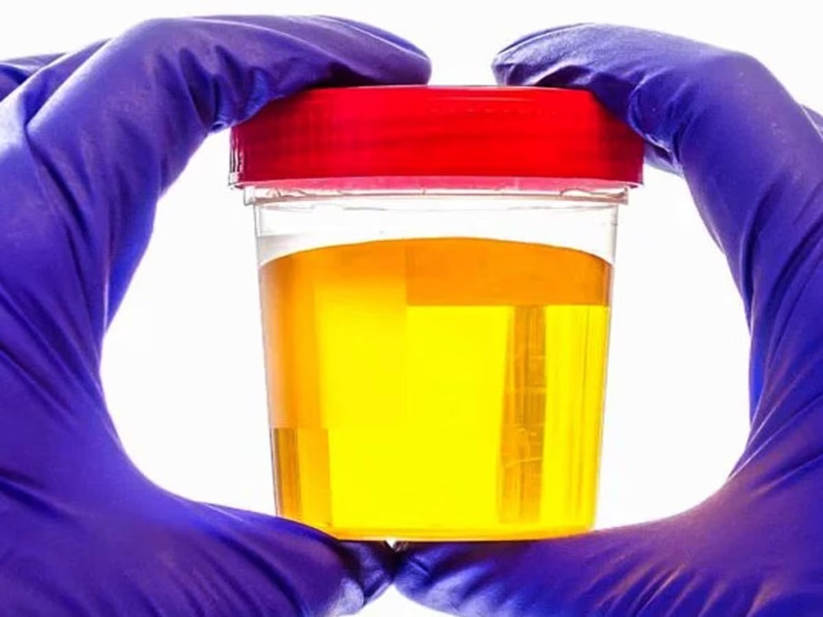 Urine or Pee Colors Indicate Health Issue Know 6 Colour Urine Cause And Affects 