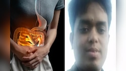 अकोल्यात नवीच दहशतः अवघड जागेच्या दुखण्यावर उपचार करणारा डॉक्टर निघाला फेक