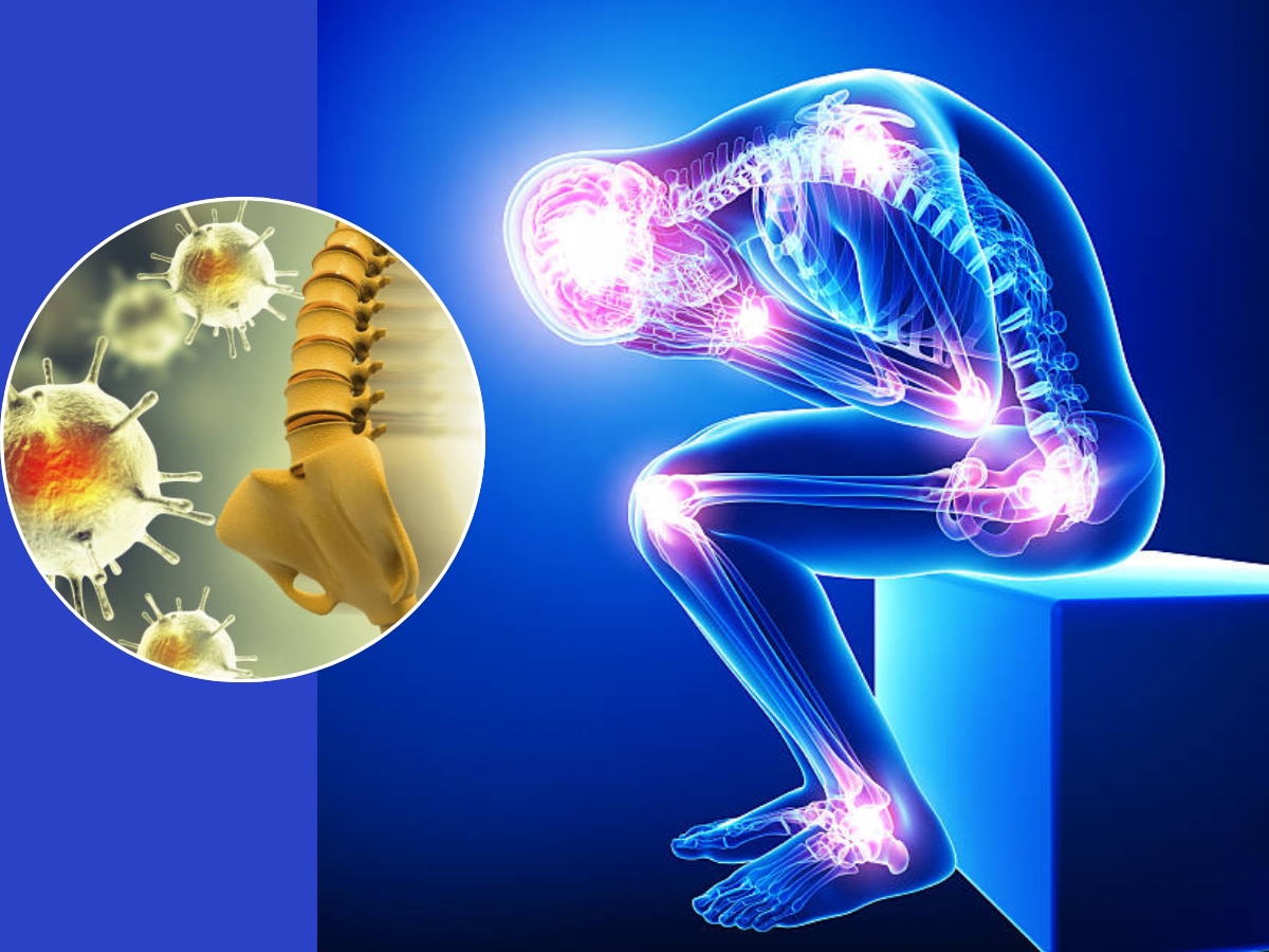 bones-cracking-noise-is-a-sign-of-bone-cancer-know-the-reason