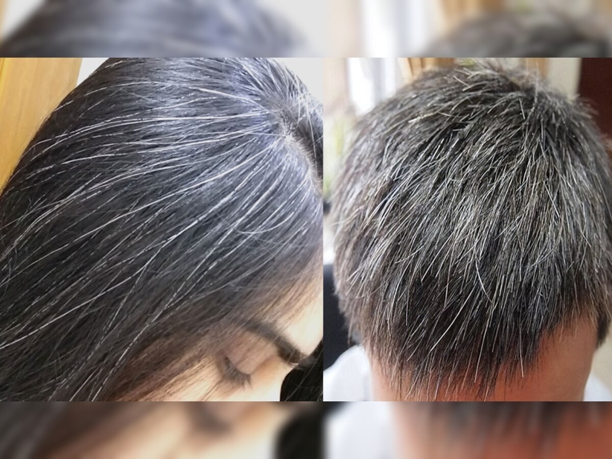 due to changing body movements experience gray hair 