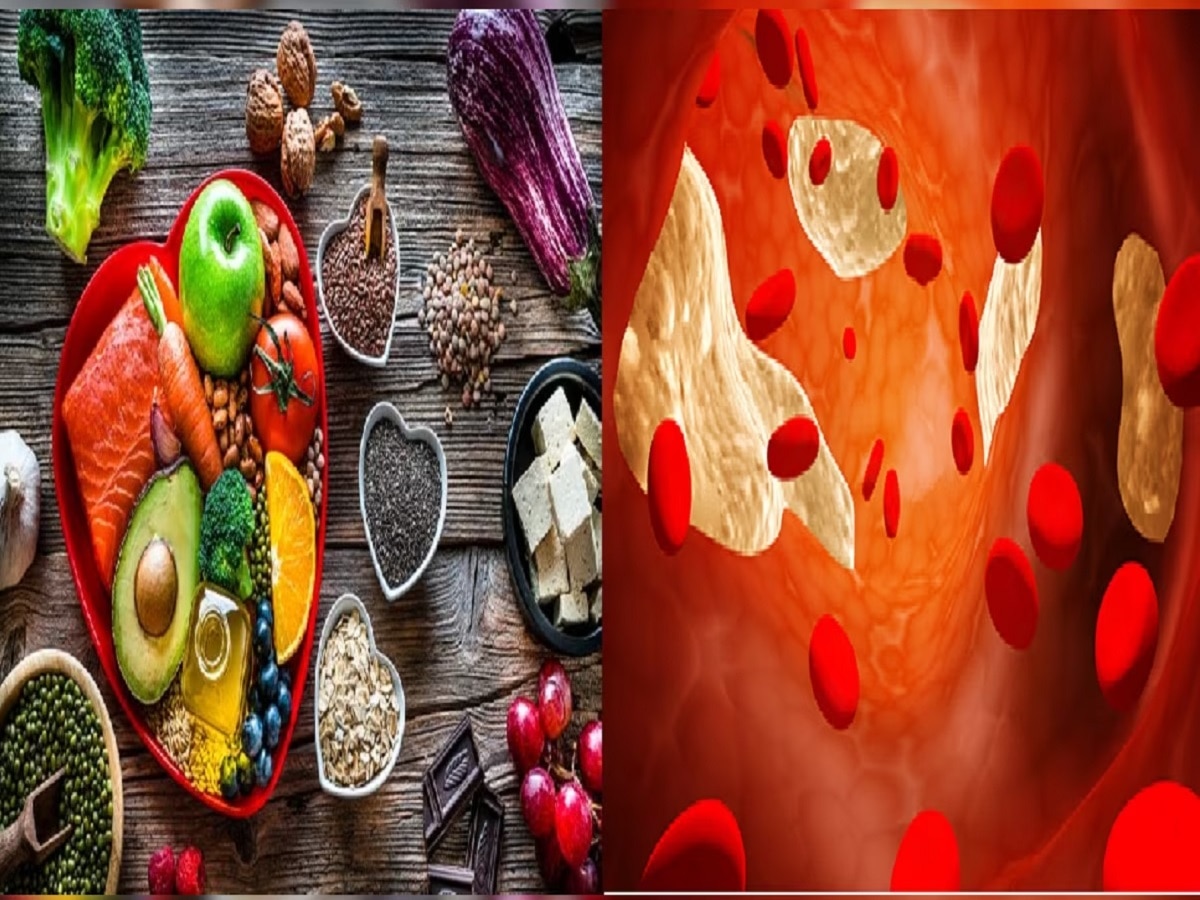 Cholesterol Symptoms: आयुष्यात कधीच वाढणार नाही कोलेस्टेरॉल, फक्त 'हे' पदार्थ खाणं सोडा! title=