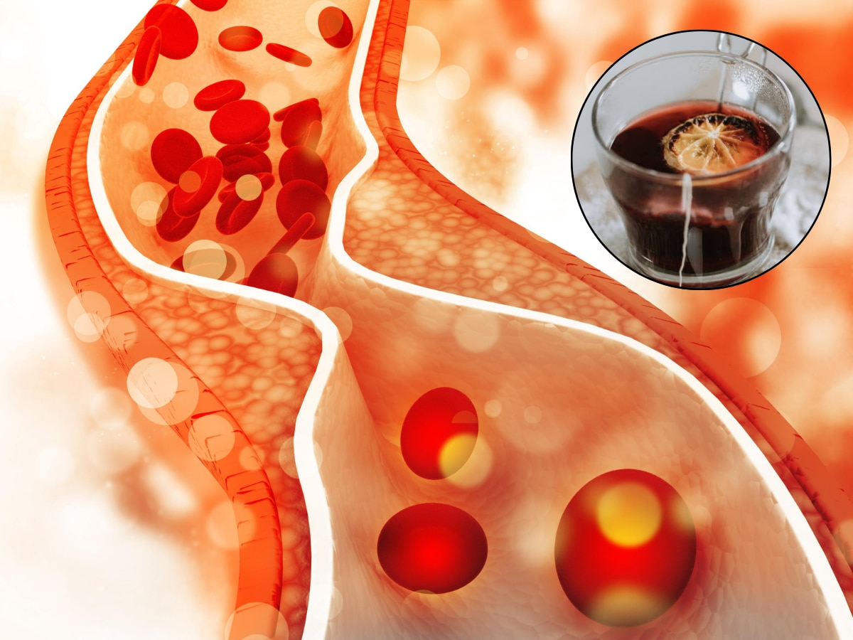 Bad Cholesterol ला मुळापासून दूर करण्यासाठी सकाळीच प्या 'हा' चहा, रात्रीपर्यंत दिसेल फरक  title=