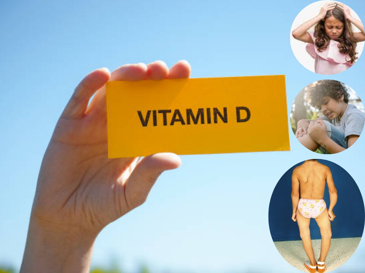 Top 5 Vitamin D Deficiency Symptoms in Children's According to Dr Ajay