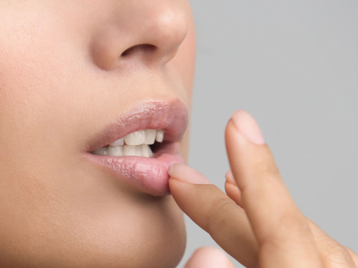 Winter Lip Care effective Tips For Moist And Crack Free Lips 