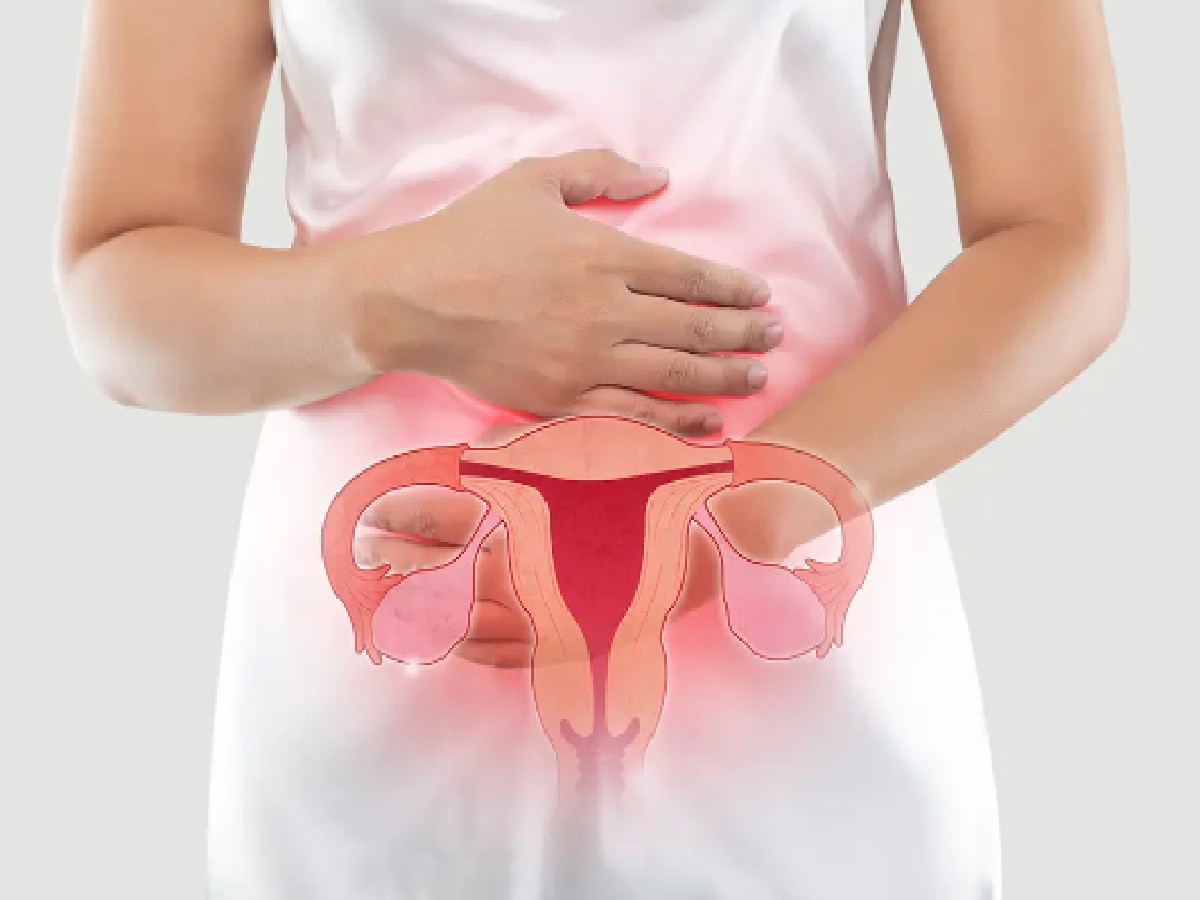 Ovarian cancer: शरीरात 'हे' बदल दिसत असतील तर दुर्लक्ष करू नका, जाणून घ्या अंडाशयाच्या कॅन्सरची लक्षणं title=