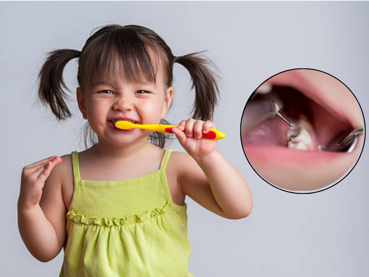 World Oral Health Day 2024 : मुलांच्या दातांमध्ये 'या' 5 कारणामुळे लागते किड title=