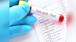 पुरुष आणि स्त्रियांमध्ये Uric Acid ची सामान्य पातळी किती असावी? पाहा चार्ट 
