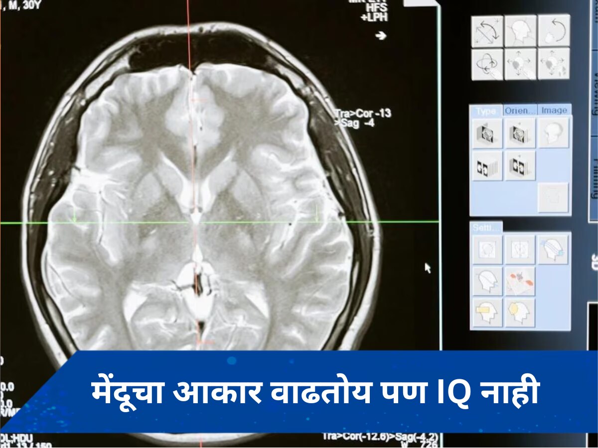 Gen Z : तरुणाईच्या मेंदूचा आकार वाढतोयस, पण IQ होतोय कमी, अभ्यासात समोर आली धक्कादायक माहिती?  title=