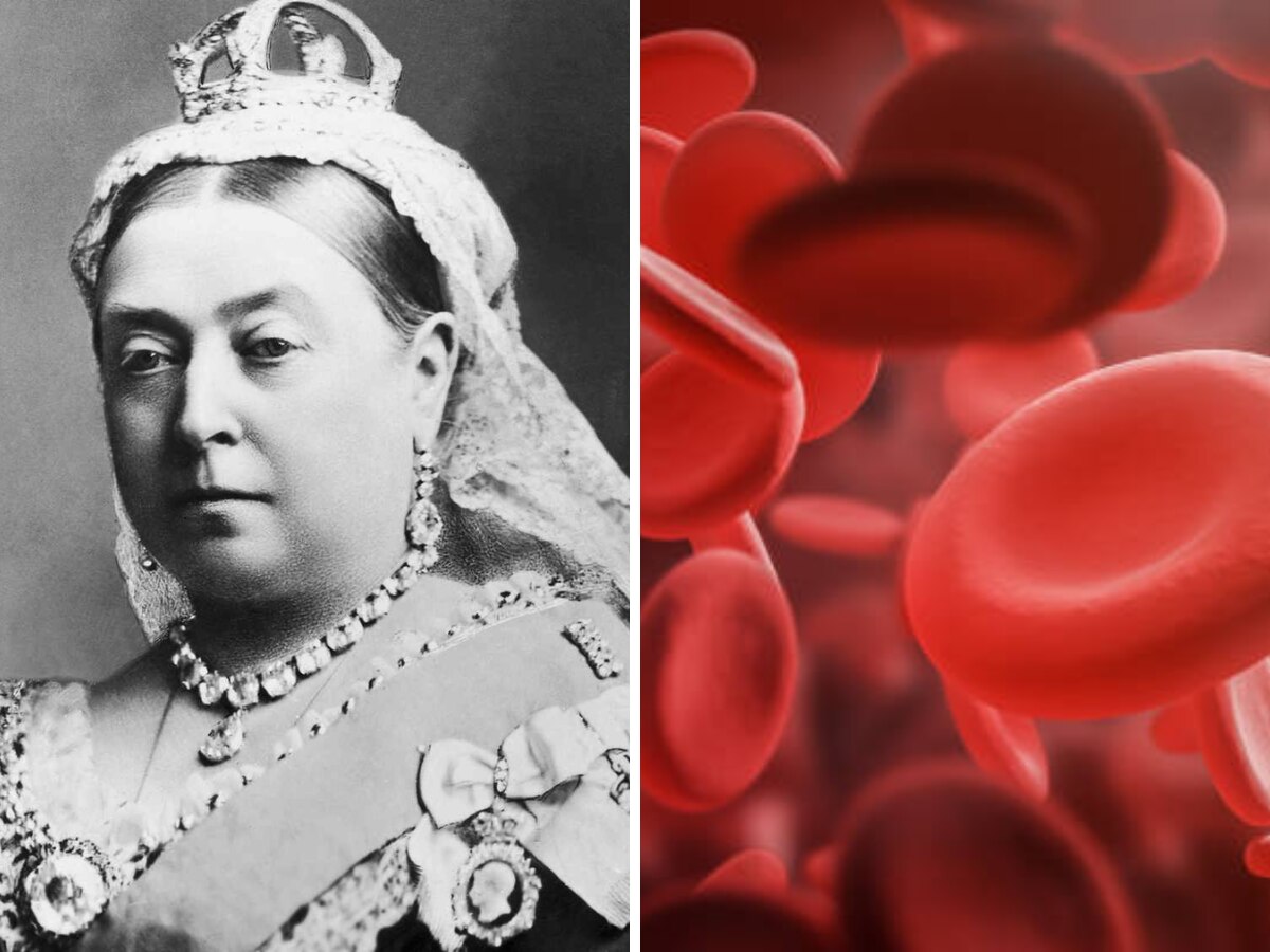 World Hemophilia Day : इंग्लंडच्या विक्टोरिया राणीला जीवघणे आजाराची लागण, रक्ताचं होतं पाणी, असे होतात हाल  title=