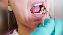 Oral Cancer: तोंडाच्या कर्करोगाशी संबंधित कोणत्या गैरसमजूती मनात असतात? जाणून घ्या