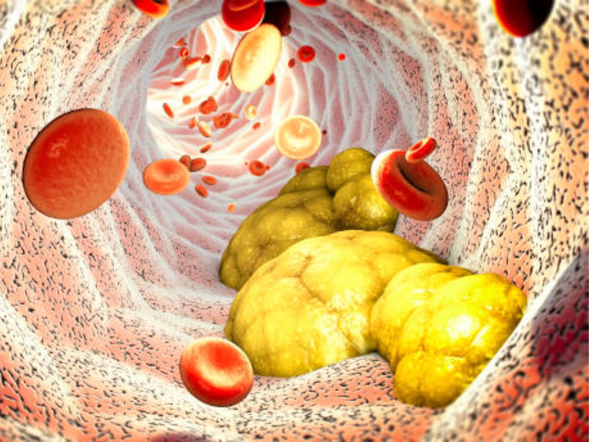 Eat thes 6 Foods in Empty Stomach early morning to control and reduce